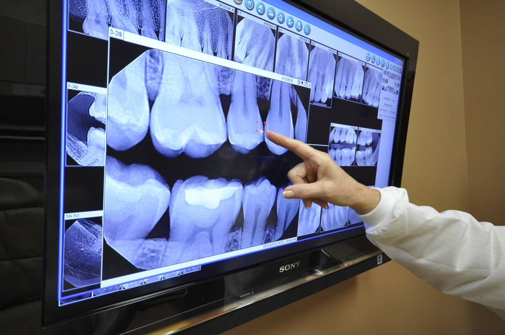 рентгеновского исследования перед стоматологическим лечением