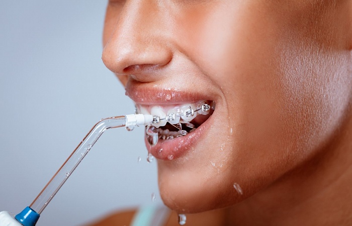Гигиена и профилактика полости рта (Отбеливание зубов)