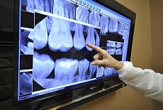 Необходимость рентгеновского исследования перед стоматологическим лечением